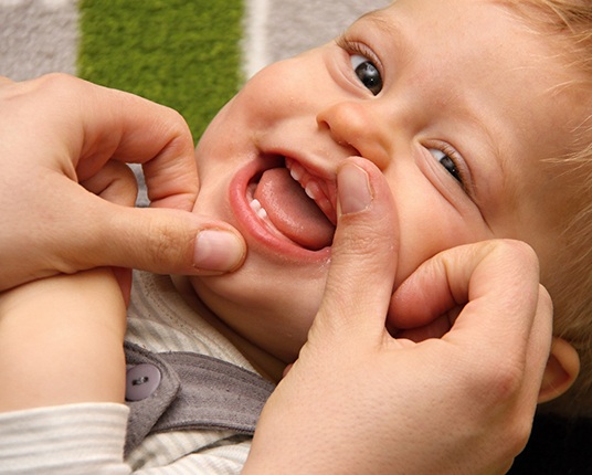 looking at a baby’s lip tie in Hamilton
