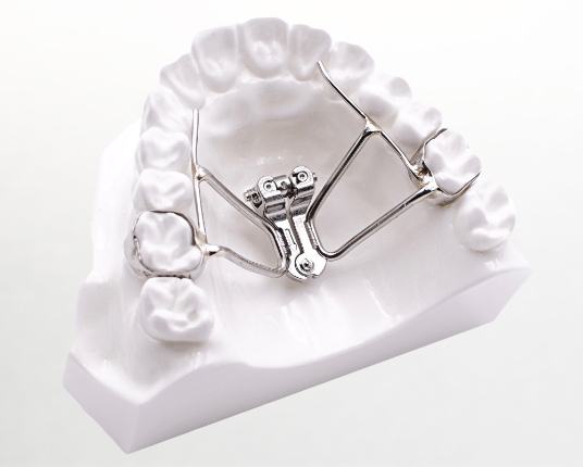 Model smile with interception orthodontics