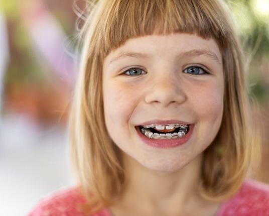 Child wearing retainers