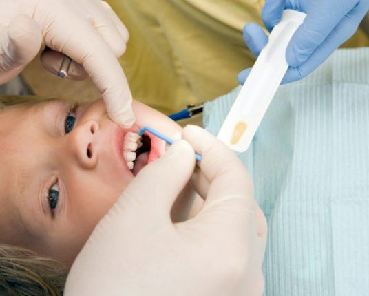 Child receiving silver diamine fluoride treatment