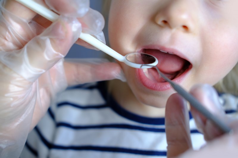 Dentist looking at a baby’s molars