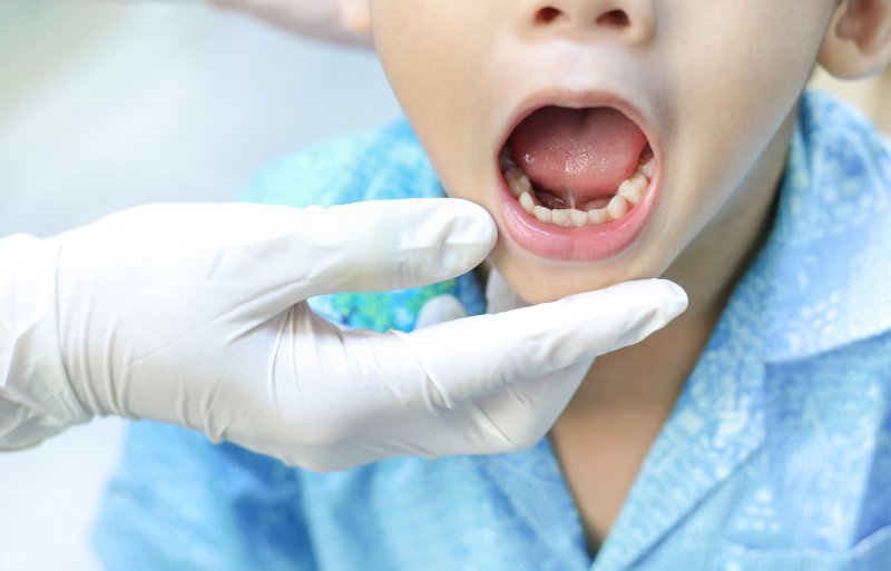 A child being treated for a lip and tongue tie